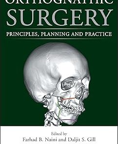 Orthognathic Surgery Principles Planning and Practice