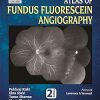 Jaypee Brothers Medical Publishers Atlas of Fundus Fluorescein Angiography
