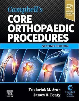 Campbell's Core Orthopaedic Procedures