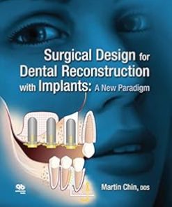 Surgical Design for Dental Reconstruction with Implants