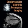 CRC Press Handbook of Cardiovascular Magnetic Resonance Imaging