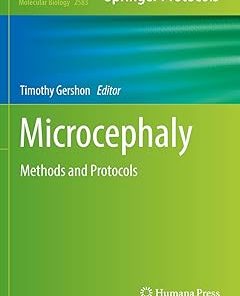Microcephaly Methods and Protocols