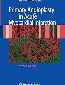 Primary Angioplasty in Acute Myocardial Infarction
