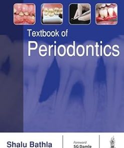 Textbook of Periodontics