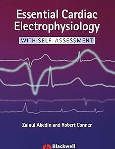 Essential Cardiac Electrophysiology