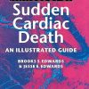 Pathology of Sudden Cardiac Death An Illustrated Guide