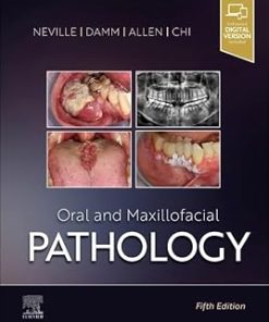 Oral and Maxillofacial Pathology