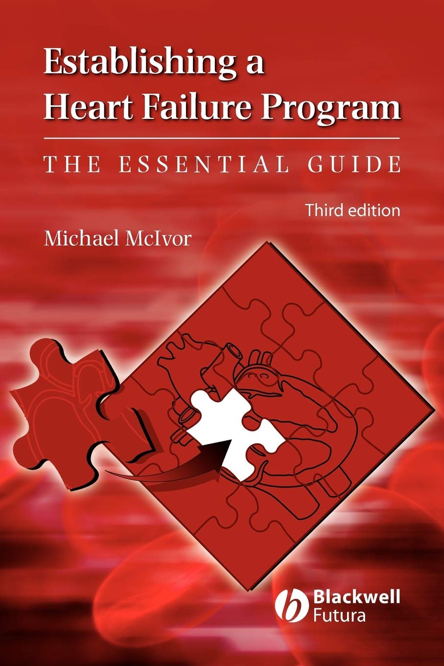 Establishing a Heart Failure Program The Essential Guide