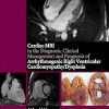 Cardiac MRI in Diagnosis Clinical Management and Prognosis of Arrhythmogenic Right Ventricular Cardiomyopathy/Dysplasia