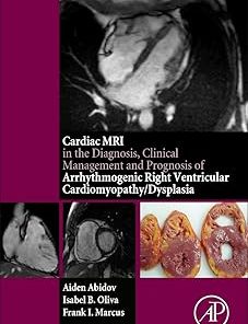 Cardiac MRI in Diagnosis Clinical Management and Prognosis of Arrhythmogenic Right Ventricular Cardiomyopathy/Dysplasia