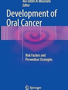 Development of Oral Cancer Risk Factors and Prevention Strategies