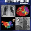 The Clinical Cardiac Electrophysiology Handbook