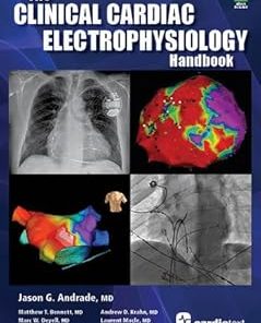 The Clinical Cardiac Electrophysiology Handbook