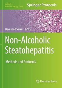 Non-Alcoholic Steatohepatitis Methods and Protocols