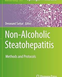 Non-Alcoholic Steatohepatitis Methods and Protocols