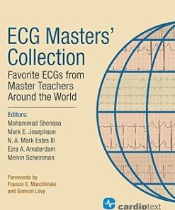 ECG Masters Collection Favorite ECGs from Master Teachers Around the World