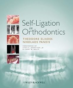 Self-Ligation in Orthodontics