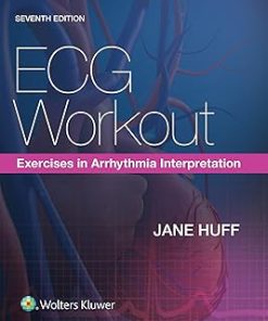 LWW ECG Workout Exercises in Arrhythmia Interpretation