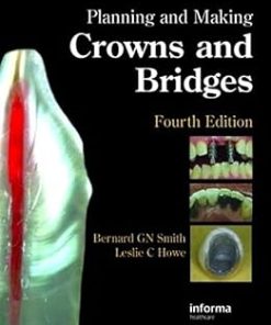 Planning and Making Crowns and Bridges