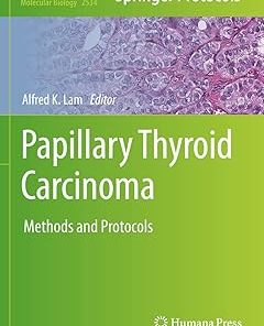Papillary Thyroid Carcinoma Methods and Protocols