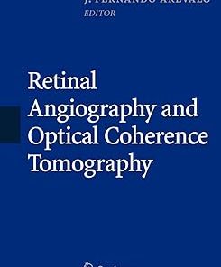 Retinal Angiography and Optical Coherence Tomography