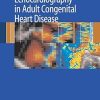 Echocardiography in Adult Congenital Heart Disease