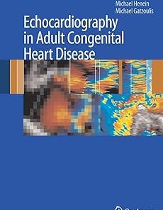 Echocardiography in Adult Congenital Heart Disease