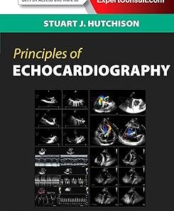 Principles of Echocardiography and Intracardiac Echocardiography