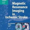 Magnetic Resonance Imaging in Ischemic Stroke