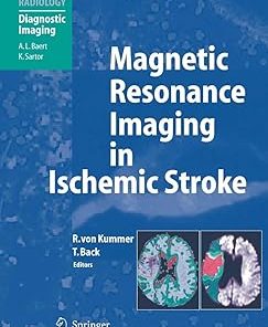 Magnetic Resonance Imaging in Ischemic Stroke