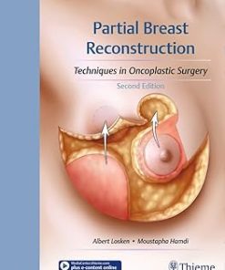 Partial Breast Reconstruction Techniques in Oncoplastic Surgery