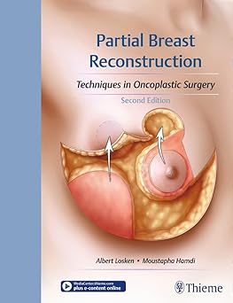 Partial Breast Reconstruction Techniques in Oncoplastic Surgery