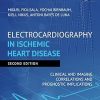 Electrocardiography in Ischemic Heart Disease