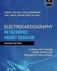 Electrocardiography in Ischemic Heart Disease