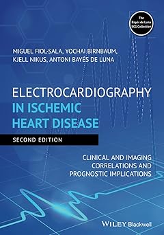 Electrocardiography in Ischemic Heart Disease