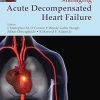 Management of Acute Decompensated Heart Failure