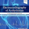 Electrocardiography of Arrhythmias A Comprehensive Review