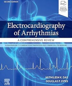 Electrocardiography of Arrhythmias A Comprehensive Review