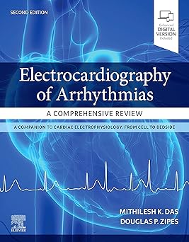 Electrocardiography of Arrhythmias A Comprehensive Review