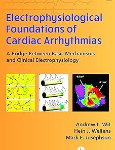 Electrophysiological Foundations of Cardiac Arrhythmias