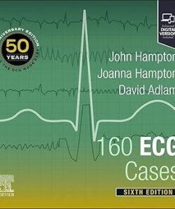 160 ECG Cases