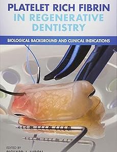 Platelet Rich Fibrin in Regenerative Dentistry
