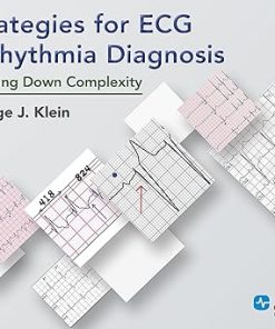 Strategies for ECG Arrhythmia Diagnosis