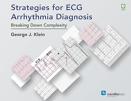 Strategies for ECG Arrhythmia Diagnosis