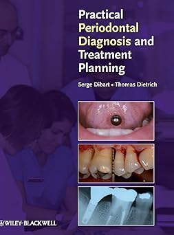 Practical Periodontal Diagnosis and Treatment Planning