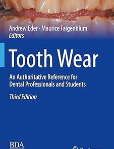 Tooth Wear An Authoritative Reference for Dental Professionals and Students