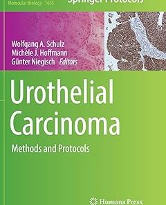 Urothelial Carcinoma Methods and Protocols