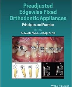 Preadjusted Edgewise Fixed Orthodontic Appliances