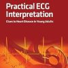 Practical ECG Interpretation Clues to Heart Disease in Young Adults
