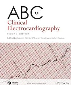 ABC of Clinical Electrocardiography